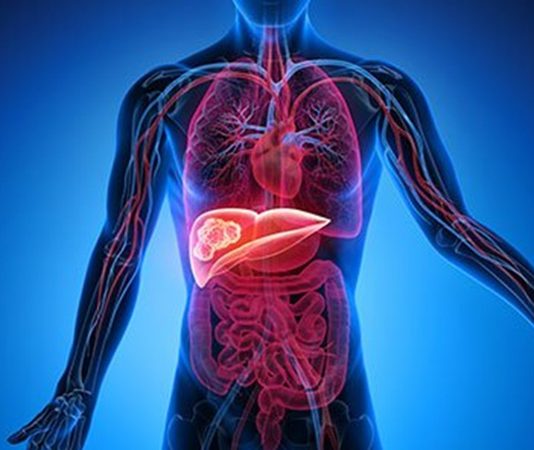 Karaciğer Temizleme Diyeti ile Sağlıklı Bir Vücut İçin Doğal Arınma Rehberi Karaciğer, vücudun en önemli detoks organlarından biridir ve sağlıklı çalışması genel sağlık açısından kritik bir rol oynar. Modern yaşamda işlenmiş gıdalar, alkol ve stres gibi faktörler karaciğerin yükünü artırabilir. Bu nedenle karaciğer temizleme diyeti, vücudu toksinlerden arındırmak, metabolizmayı desteklemek ve enerji seviyelerini yükseltmek için etkili bir yöntem olarak öne çıkıyor. Bu diyet, doğru uygulandığında hem besleyici hem de güvenli bir yaşam tarzı sağlar. Konulu bir haber görseli.